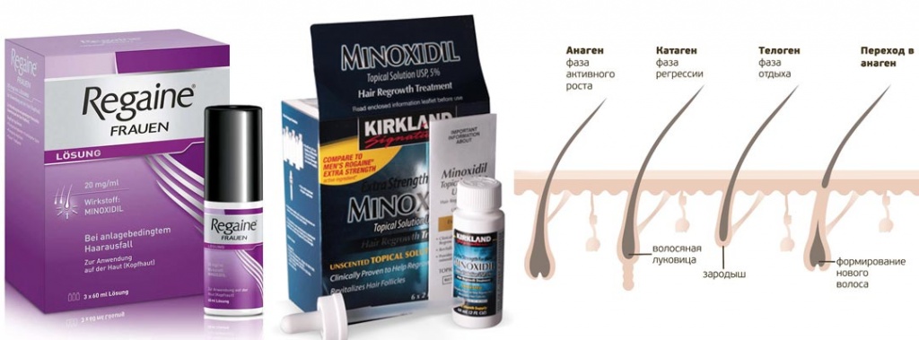 Препараты от выпадения волос на основе миноксидила для волос